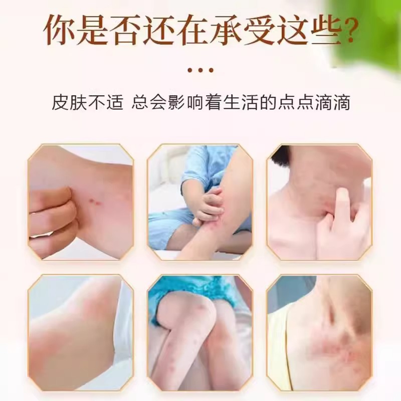 Five-Toxin Anti-Itch Cream, Plant-Based Mosquito Bite Cream, Dry Cracked Skin Itching Cream, Peeling Soothing Cream, Anti-Itch Herbal Antibacterial Cream - Image 2