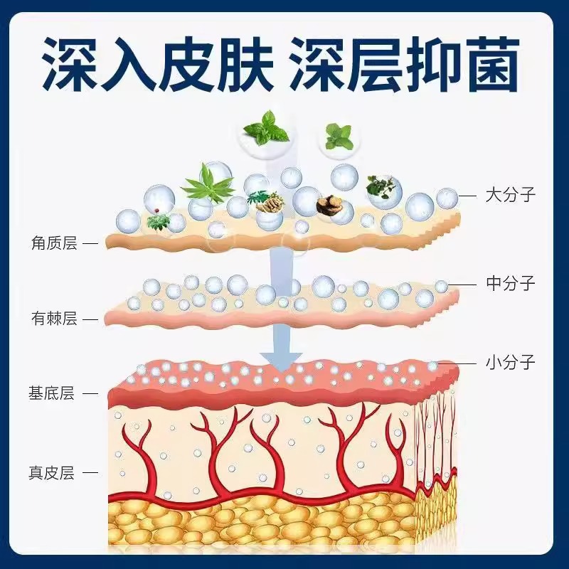 Five-Toxin Anti-Itch Cream, Plant-Based Mosquito Bite Cream, Dry Cracked Skin Itching Cream, Peeling Soothing Cream, Anti-Itch Herbal Antibacterial Cream - Image 4